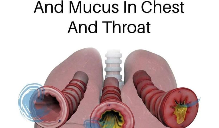 8 Ways To Get Rid Of Phlegm And Mucus In Chest And Throat