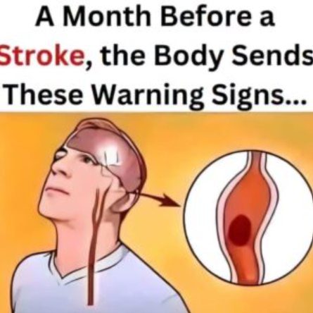 A Month Before a Stroke, Your Body Sends These Signals…