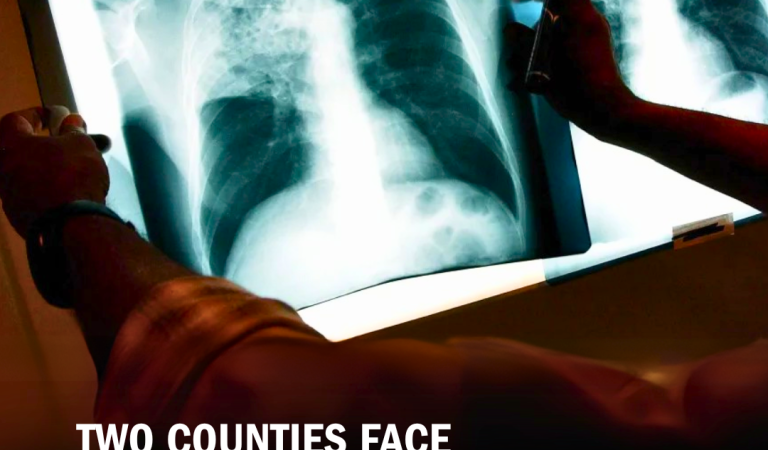 Kansas tuberculosis outbreak becomes the largest in U.S. history – Latest updates