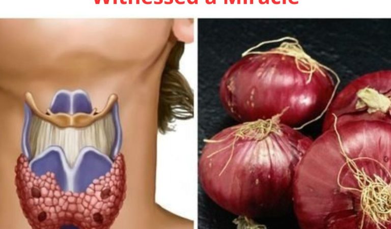 He Slept With a Red Onion Around His Neck: When He Woke Up He Witnessed a Miracle