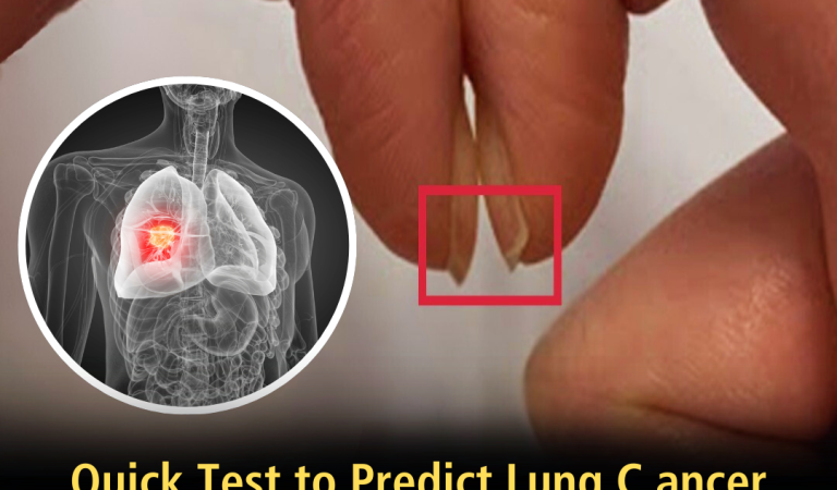 This simple fingernail test could help save your life