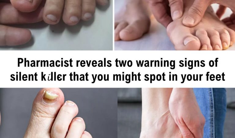Pharmacist reveals two warning signs of silent killєr that you might spot in your feet