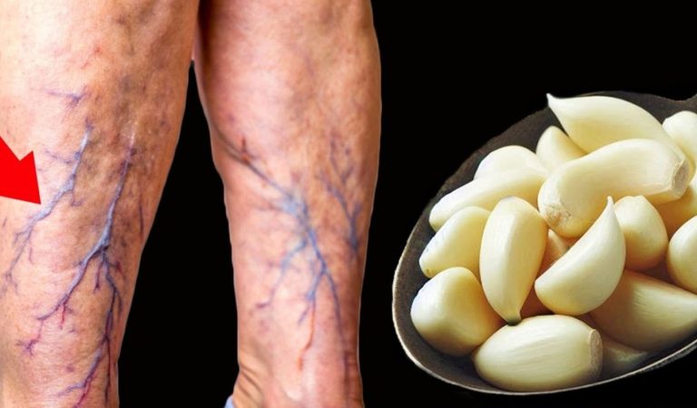 Here’s how garlic works its magic on your veins
