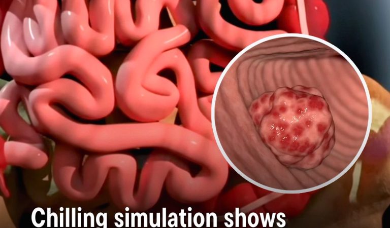 Chilling simulation has shown just how a person d!es from canc3r