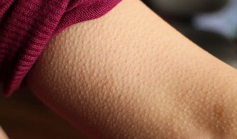 If you get goosebumps for no reasons, it is a clear sign that you are….