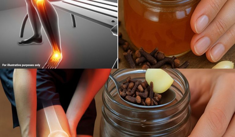 Garlic, Honey, and Cloves – A powerful natural remedy packed with health benefits